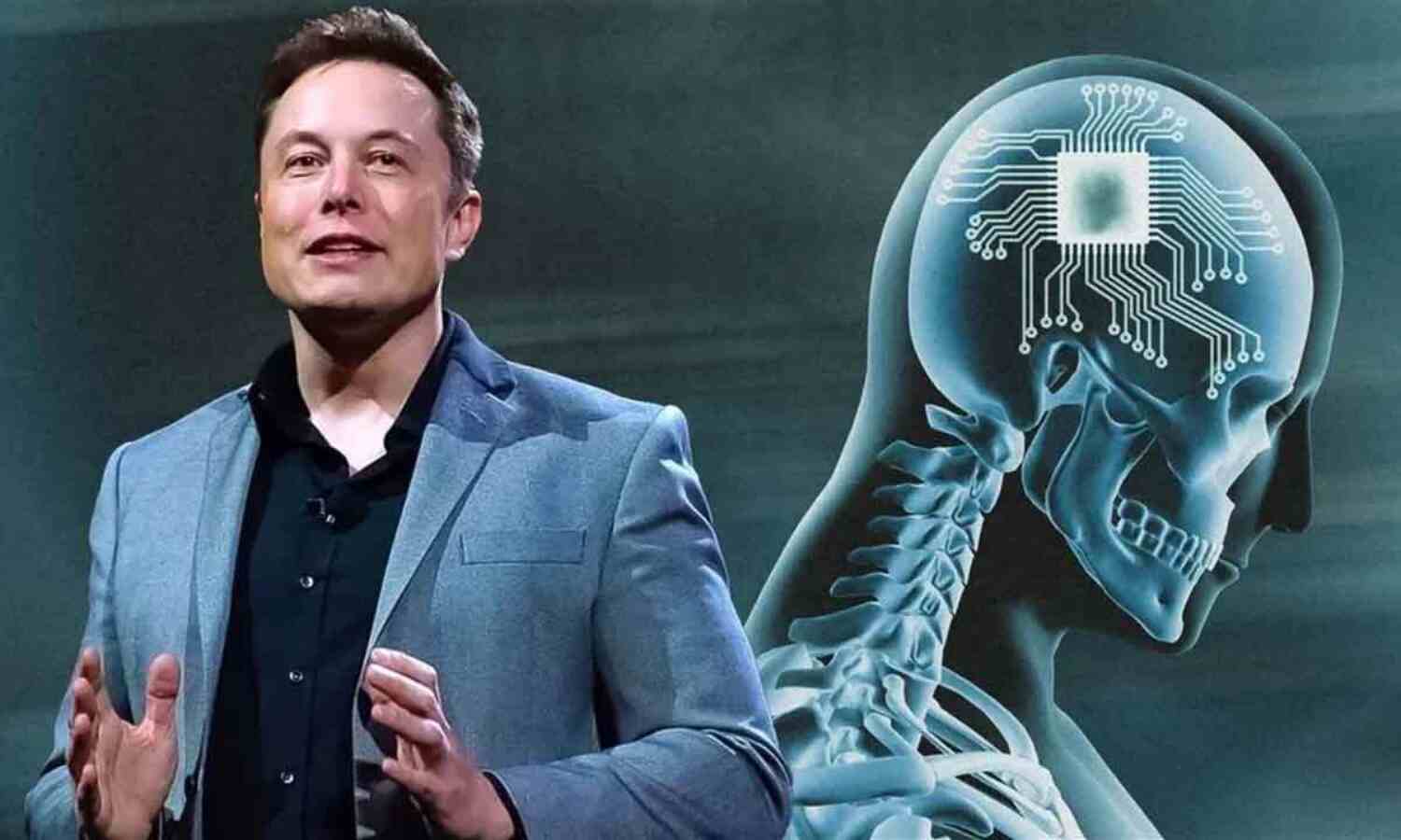 Elon Musk's Latest Venture Neuralink Sparks Major Buzz: Groundbreaking Brain Tech Meets Ethical Dilemmas