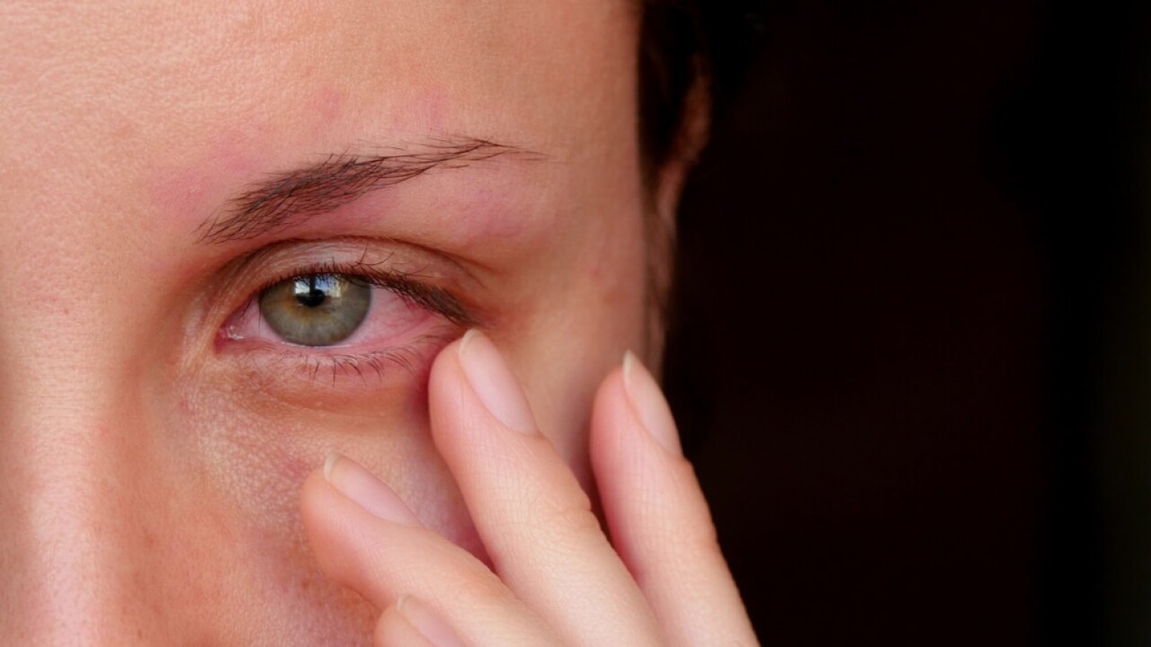 How Does Eye Syphilis Occur? Doctors Are Seeing Severe Symptoms Due to the STD Epidemic
