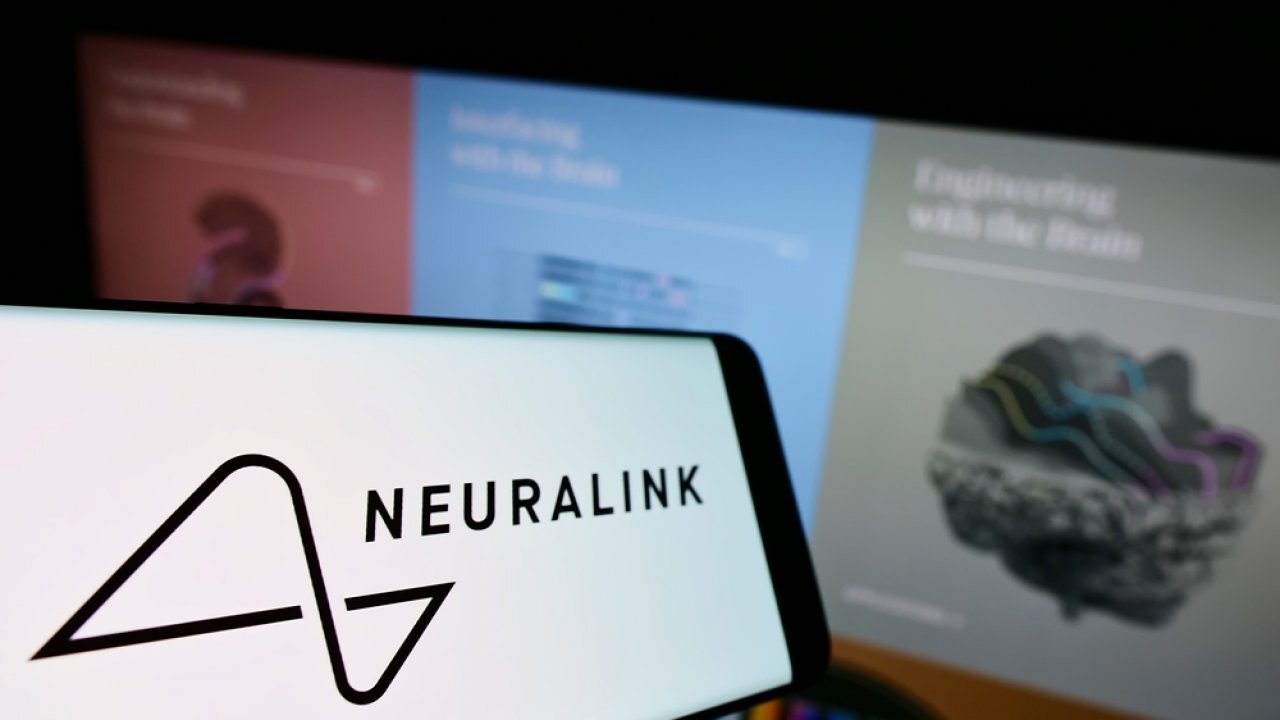 Elon Musk's Latest Breakthrough FDA Approves Neuralink to Start Second Brain Chip Implant