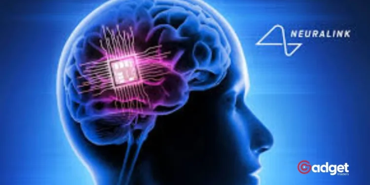 Noland Arbaugh's Journey as the First Human to Have a Neuralink Device Implanted in His Brain