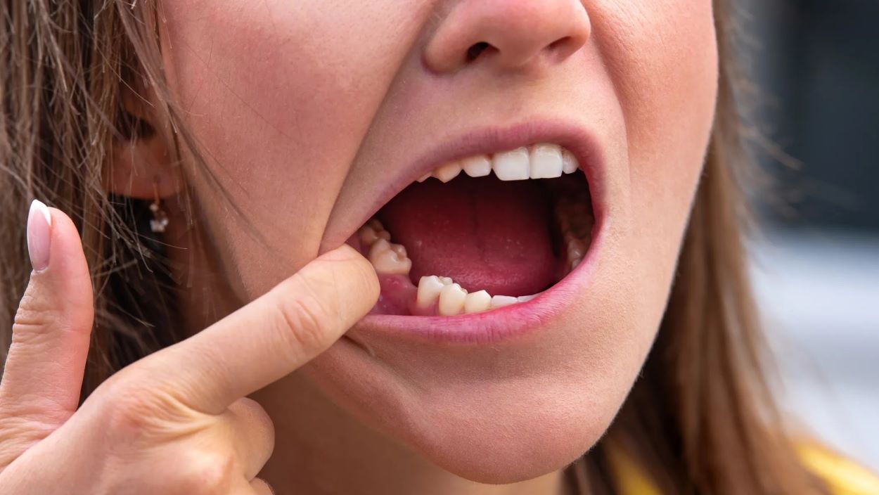 Meet the New Breakthrough A Drug That Can Actually Regrow Your Teeth Is Heading to Trials-
