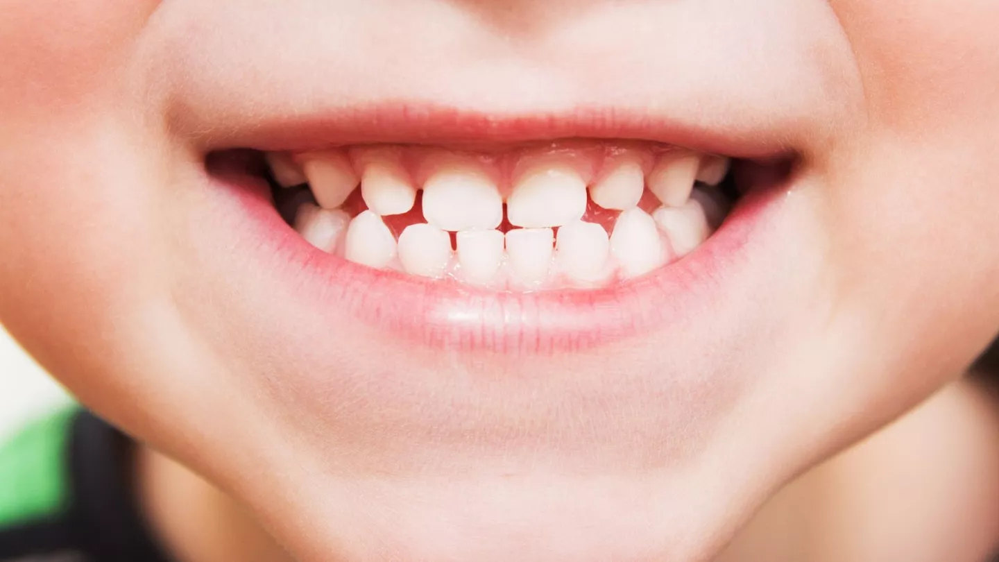 Meet the New Breakthrough A Drug That Can Actually Regrow Your Teeth Is Heading to Trials---